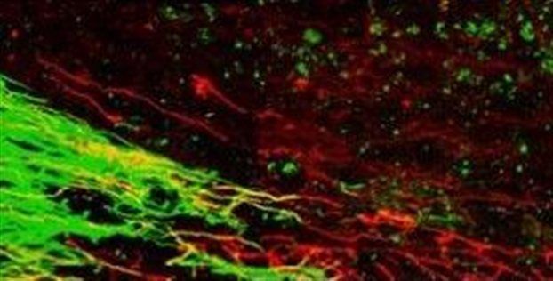 Αναγέννηση νευρικών κυττάρων σε παράλυτα ζώα